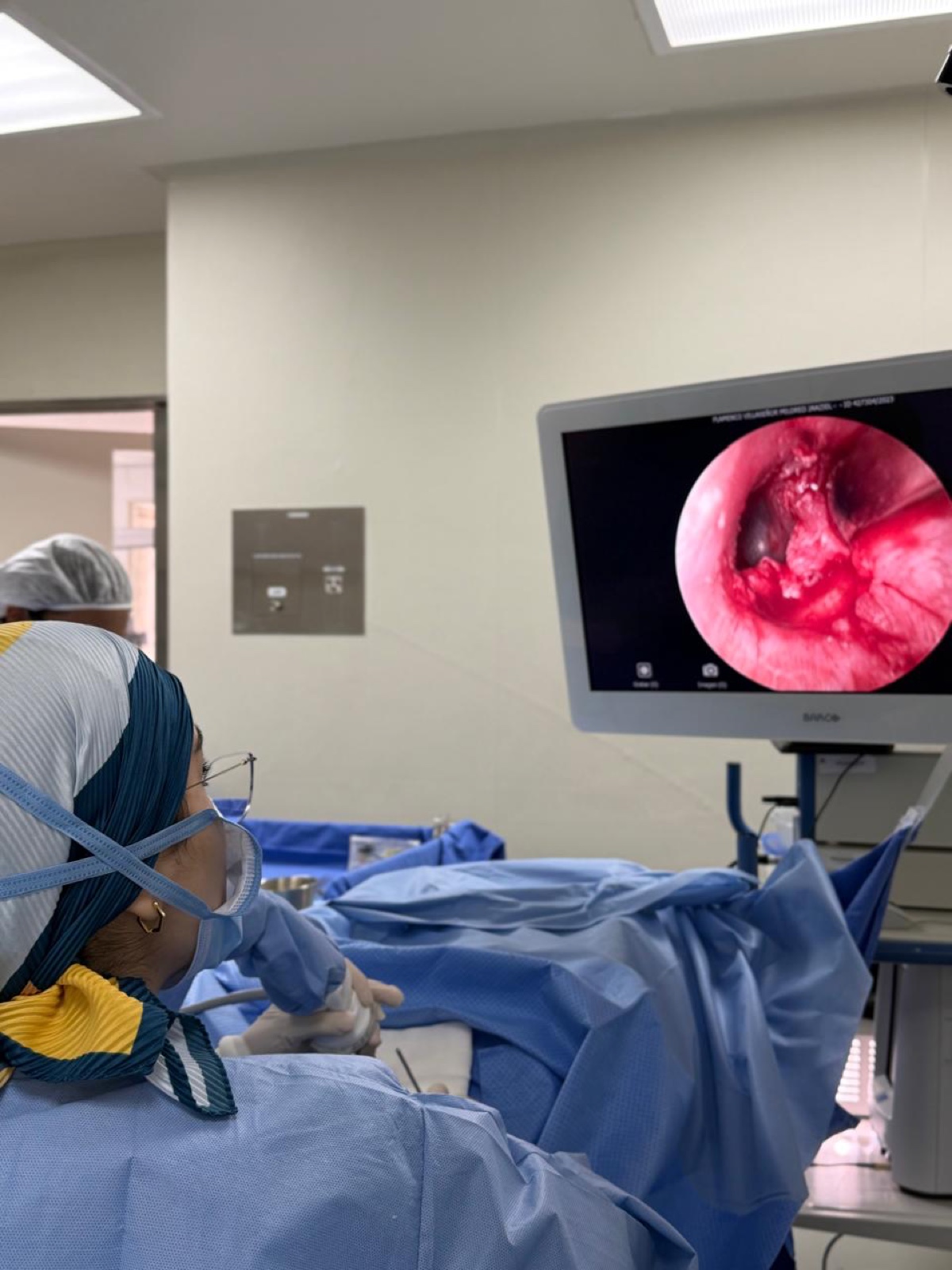 Quirófano con monitor de endoscopía